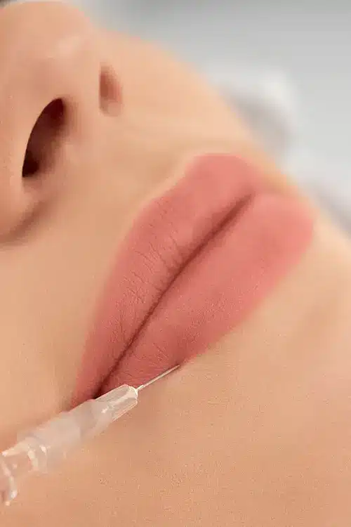 imagem harmonizacao facial