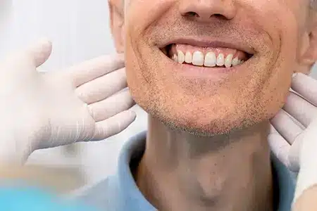 Imagem implantes odontologia