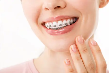 imagem ortodontia odontologia