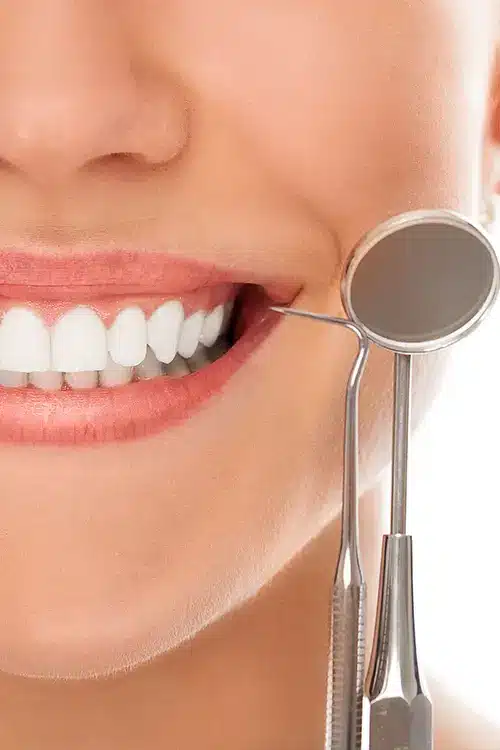 imagem odontologia estetica vertical
